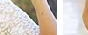 dysarthria,